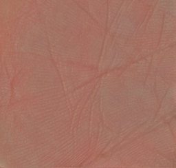 RELAST: skin image (homogenized)